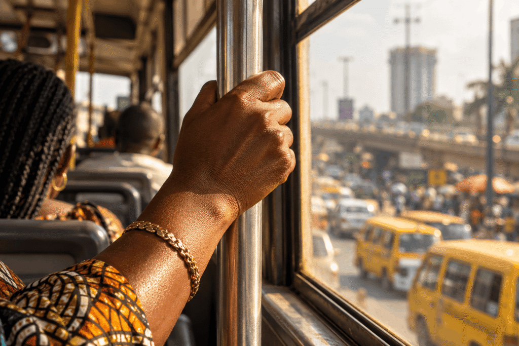 Why Are My Knuckles Darker Than the Rest of My Hands? 4 A passenger with discolored knuckles holds a metal pole on a bus overlooking a busy street with yellow vans.